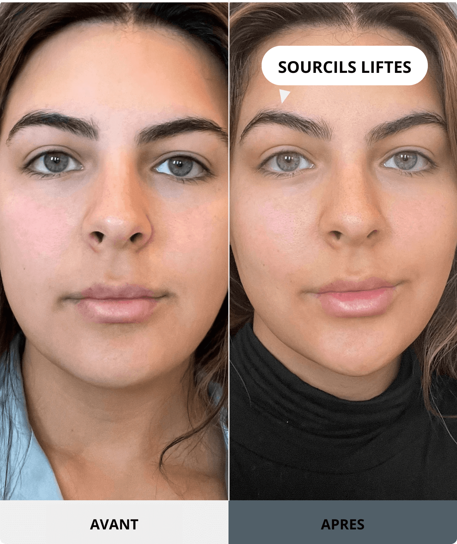 Image avant/après montrant une jeune femme. Côté "Avant" : sourcils dans leur position naturelle. Côté "Après" : ses sourcils sont visiblement liftés et plus arqués, avec une flèche pointant vers le sourcil et le texte "SOURCILS LIFTÉS". Ce résultat est obtenu avec le produit Nanosculpt.