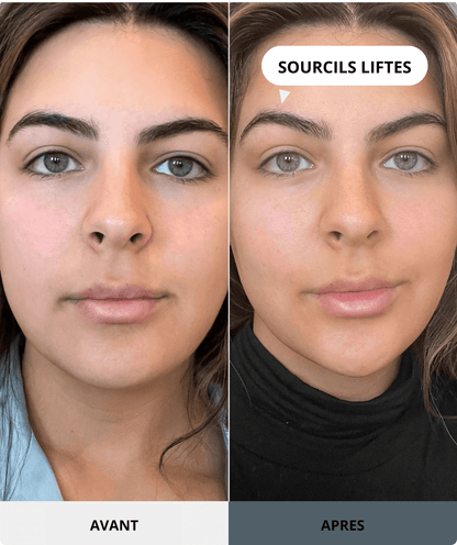 Image avant/après montrant une jeune femme. Côté "Avant" : sourcils dans leur position naturelle. Côté "Après" : ses sourcils sont visiblement liftés et plus arqués, avec une flèche pointant vers le sourcil et le texte "SOURCILS LIFTÉS". Ce résultat est obtenu avec le produit Nanosculpt.